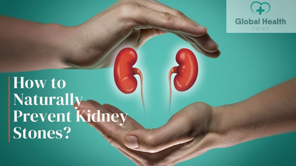 ppt-how-to-naturally-prevent-kidney-stones-powerpoint-presentation