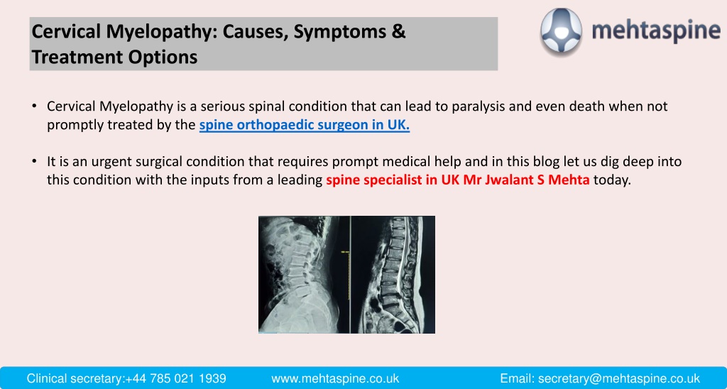 PPT - Cervical Myelopathy: Causes, Symptoms & Treatment Options ...