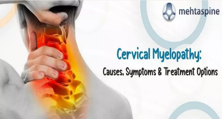 PPT - Cervical Myelopathy: Causes, Symptoms & Treatment Options ...