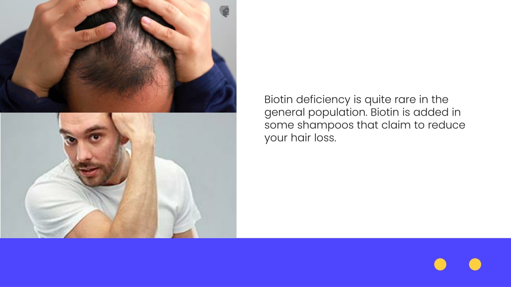 PPT - Hair Loss Treatment: Use of Biotin to Prevent It PowerPoint ...