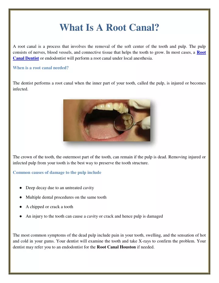 ppt-what-is-a-root-canal-powerpoint-presentation-free-download-id