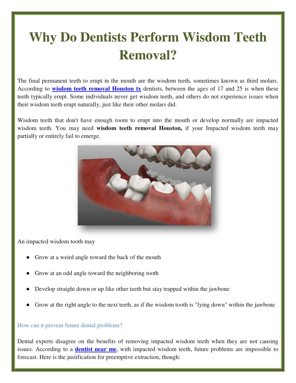 PPT - Why Do Dentists Perform Wisdom Teeth Removal? PowerPoint ...