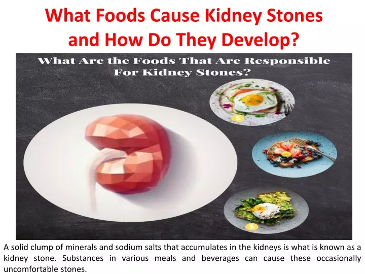 ppt-what-foods-cause-kidney-stones-and-how-do-they-develop-powerpoint