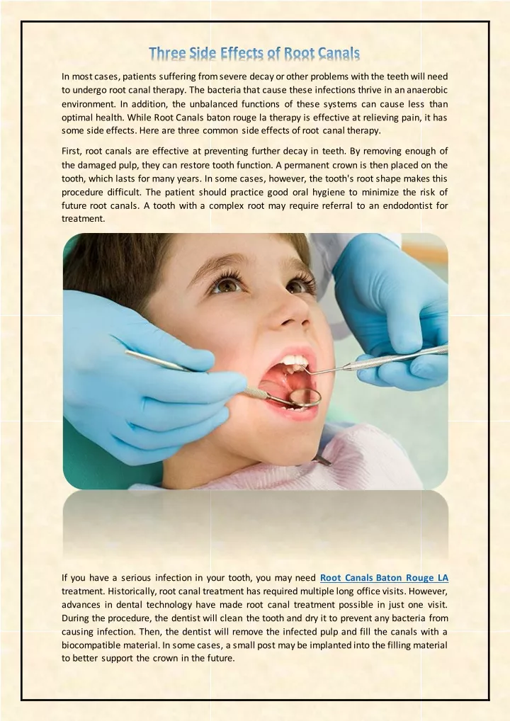 ppt-three-side-effects-of-root-canals-powerpoint-presentation-free