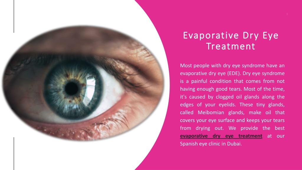 PPT evaporative dry eye treatment PowerPoint Presentation, free download ID11549578