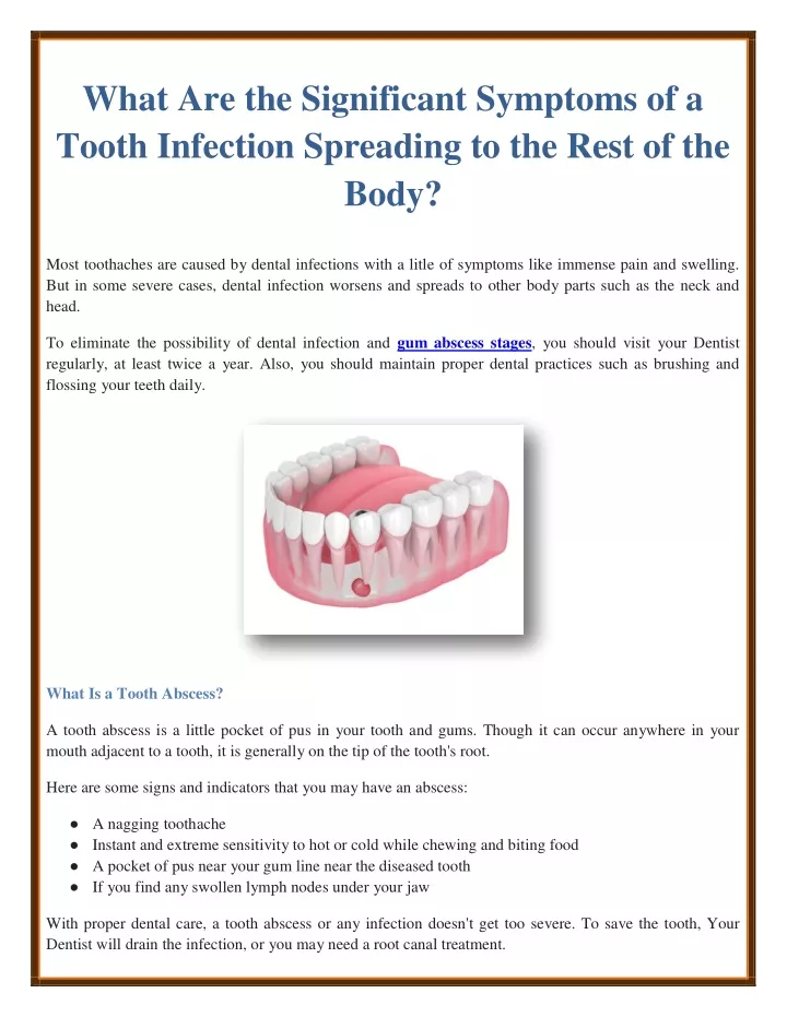 PPT - What Are the Significant Symptoms of a Tooth Infection Spreading ...