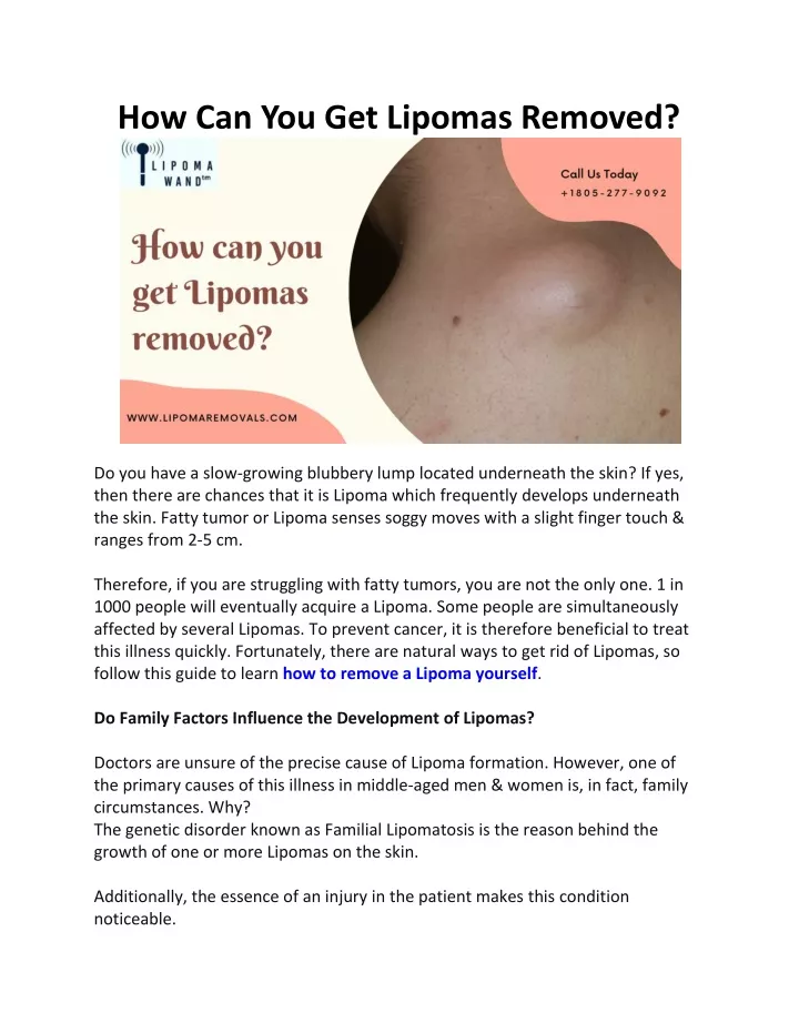 PPT How Can You Get Lipomas Removed PowerPoint Presentation, free download ID11552213