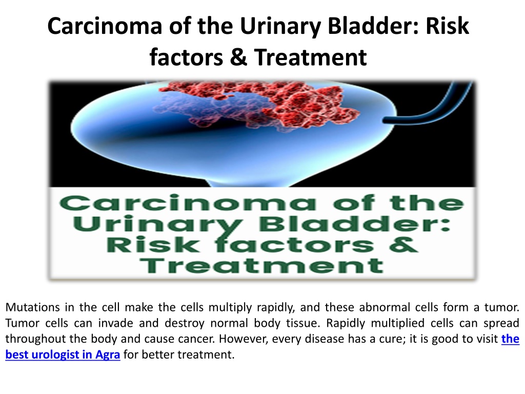 PPT - Human bladder cancer treatment options and risk factors ...