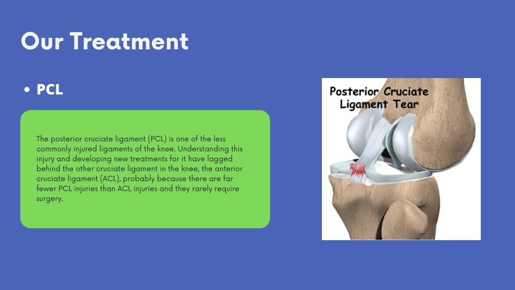 PPT - Best Ortho Doctor in Chandigarh PowerPoint Presentation, free ...