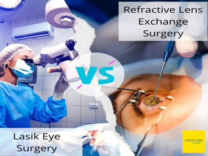 Rle Eye Surgery Side Effects