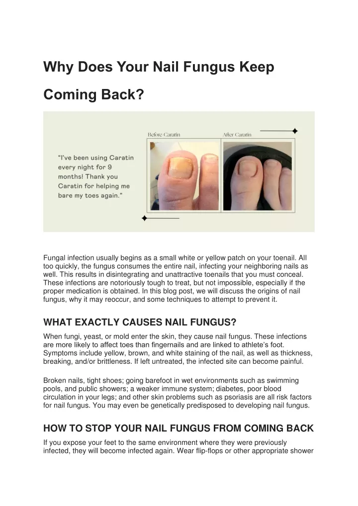 ppt-why-does-your-nail-fungus-keep-coming-back-powerpoint