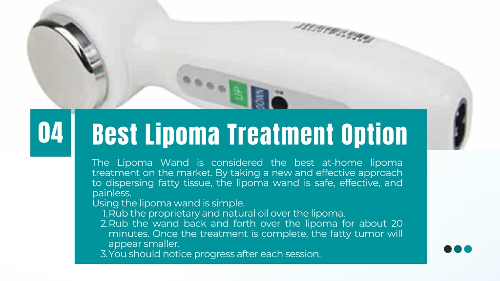 Ppt The Best Lipoma Treatment Without Surgery With Lipoma Wand Powerpoint Presentation Id 