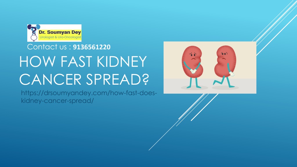 PPT - How fast Kidney Cancer spread PowerPoint Presentation, free ...