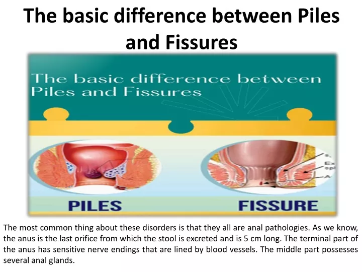 Ppt The Main Difference Between Cracks And Heaps Powerpoint Presentation Id