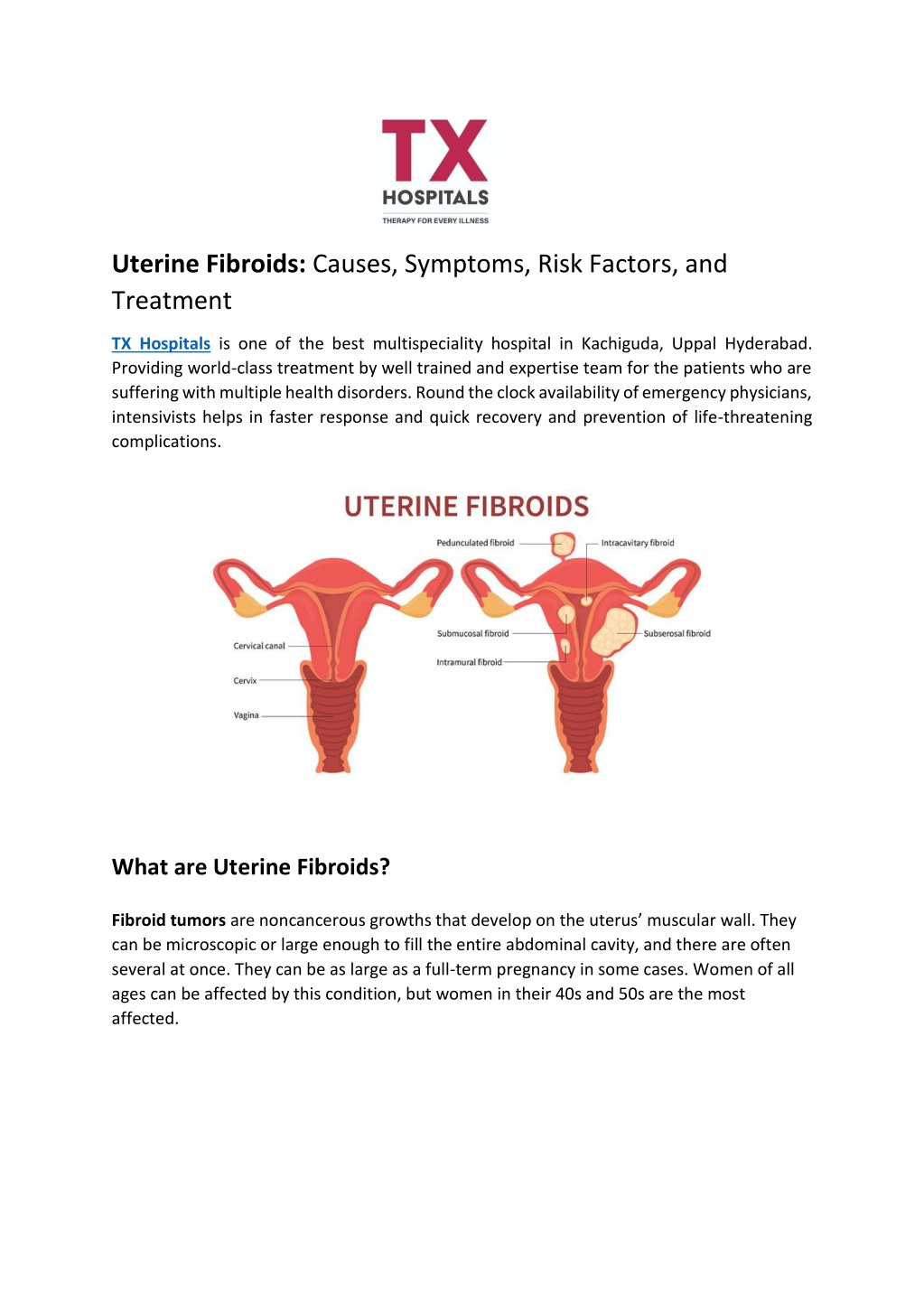 powerpoint presentation on uterine fibroids