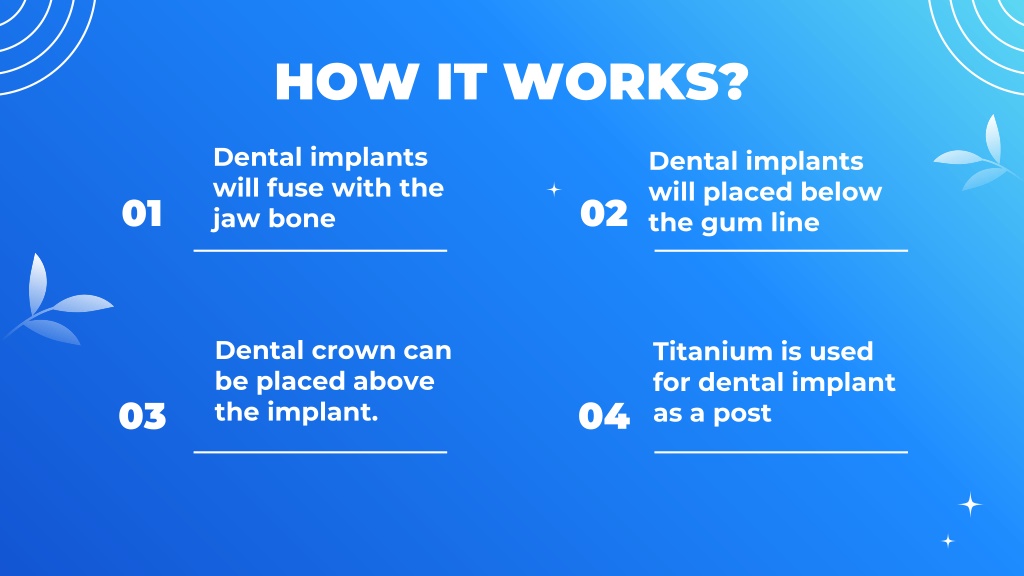 PPT Dental Implant Dubai PowerPoint Presentation, free download ID