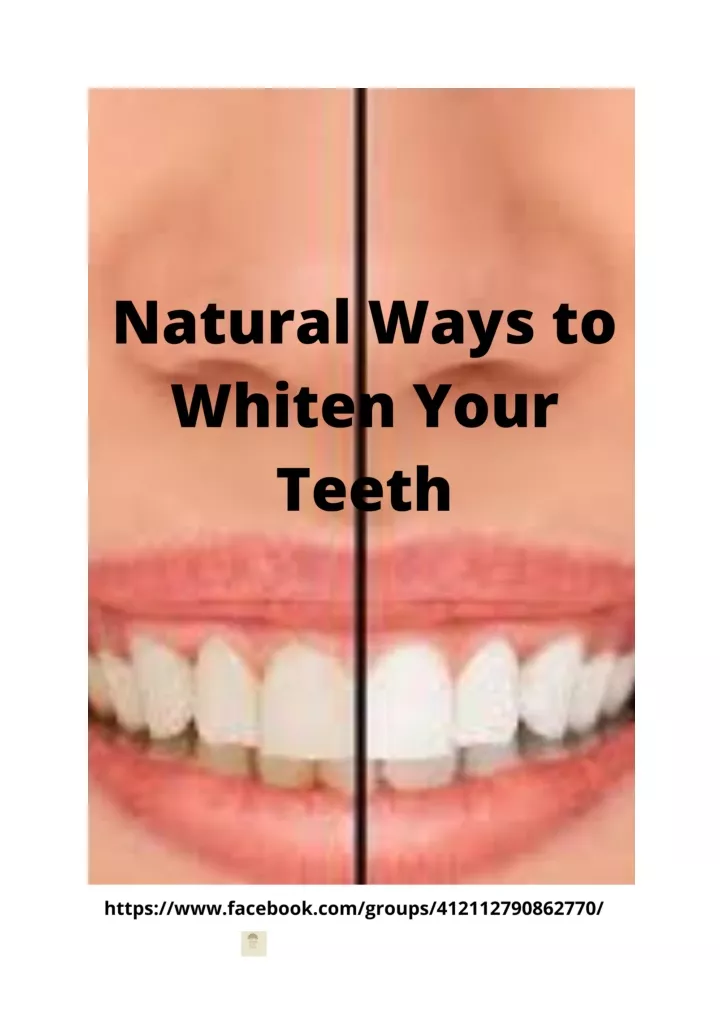 Ppt Natural Ways To Whiten Your Teeth Powerpoint Presentation Free Download Id