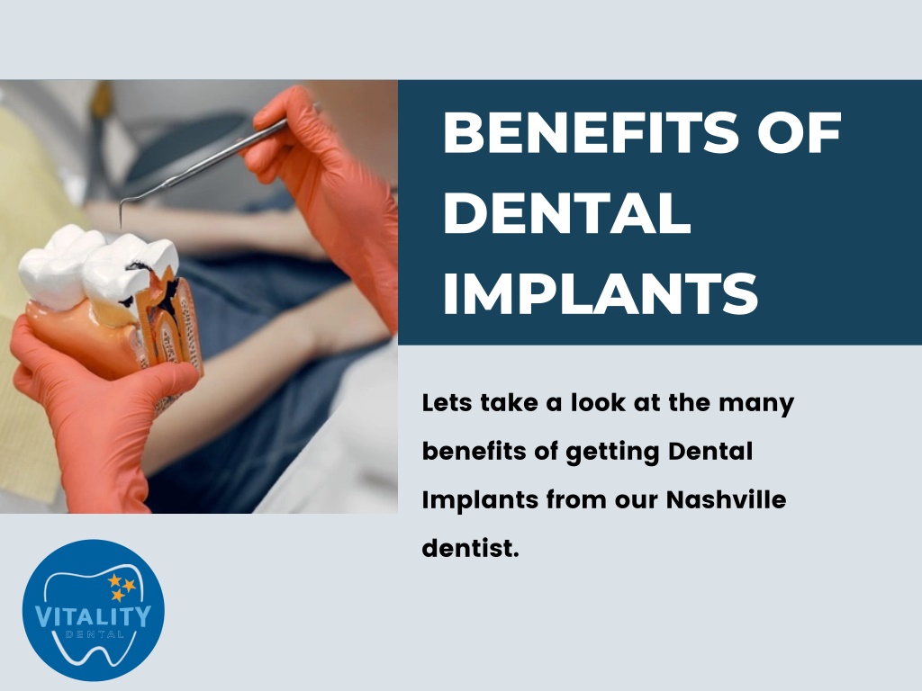 Ppt The Top Benefits Of Dental Implants You Didn T Know About Powerpoint Presentation Id