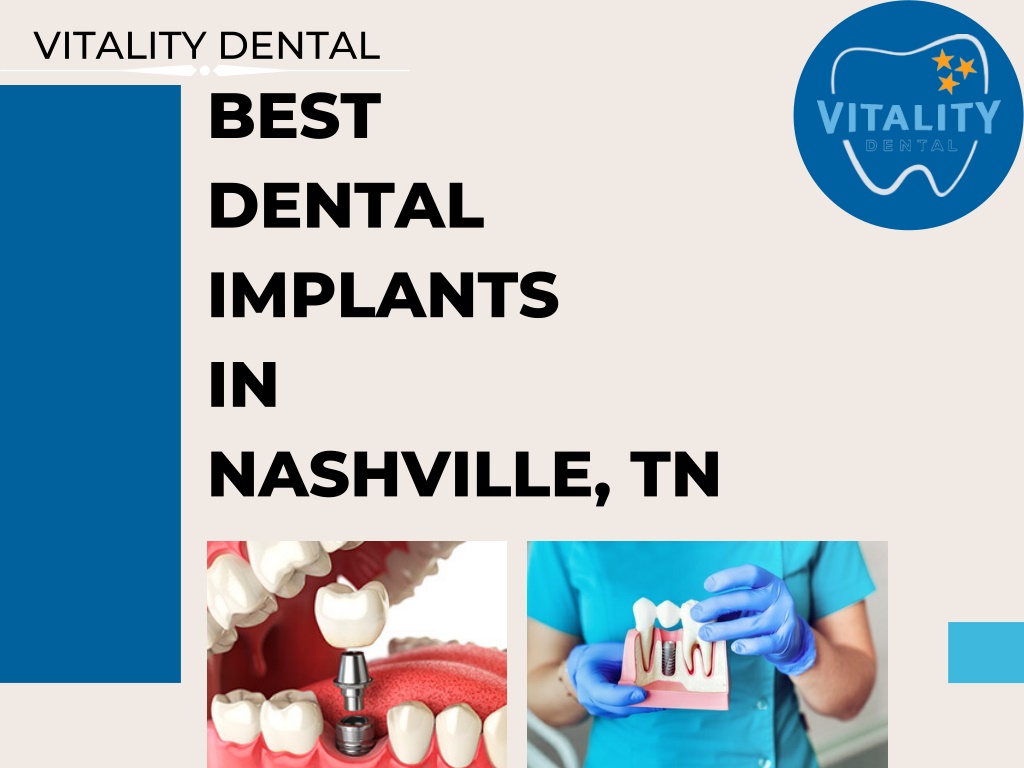 PPT The Top 5 Benefits of Dental Implants You Didn't Know About