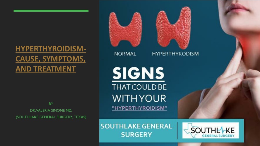 Ppt Hyperthyroidism Cause Symptoms And Treatment Powerpoint