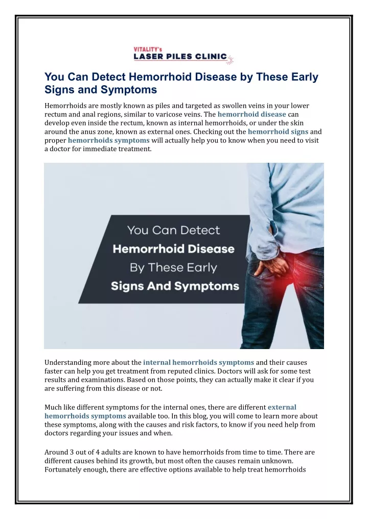 Ppt You Can Detect Hemorrhoid Disease By These Early Signs And