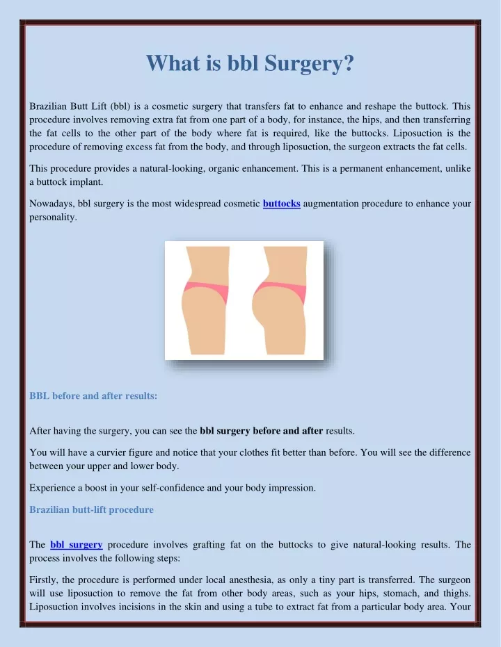 PPT - What is bbl Surgery? PowerPoint Presentation, free download - ID ...