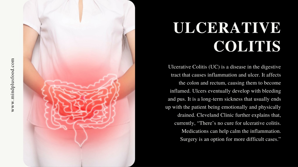 PPT Ulcerative Colitis Diet Guide Types, Treatments & Ketogenic