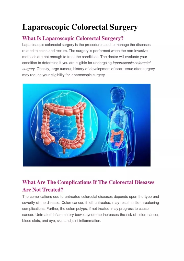 PPT Laparoscopic Colorectal Surgery In Delhi By Dr Neeraj Goel   Laparoscopic Colorectal Surgery N 