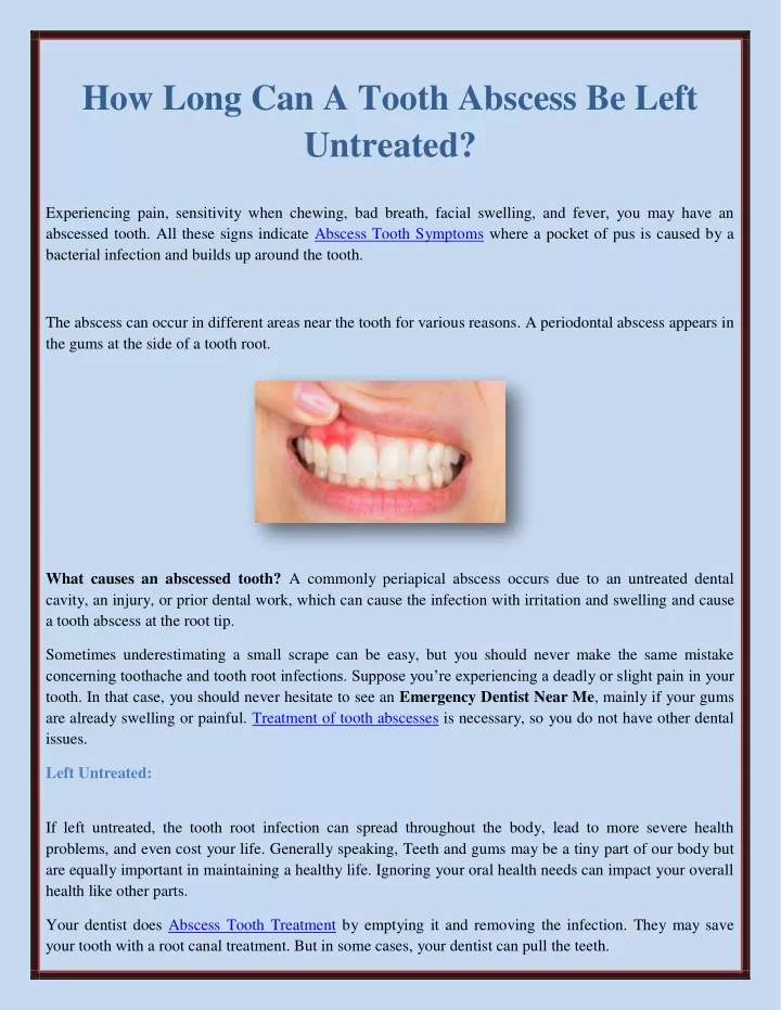 ppt-how-long-can-a-tooth-abscess-be-left-untreated-powerpoint