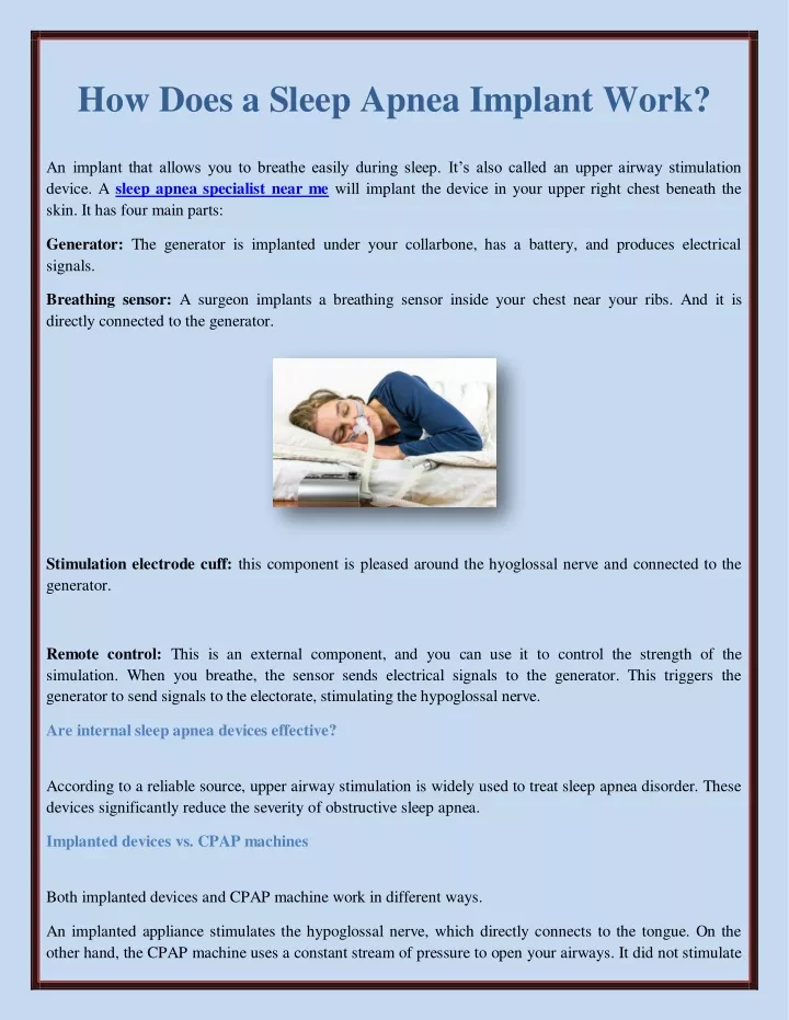 Ppt How Does A Sleep Apnea Implant Work Powerpoint Presentation