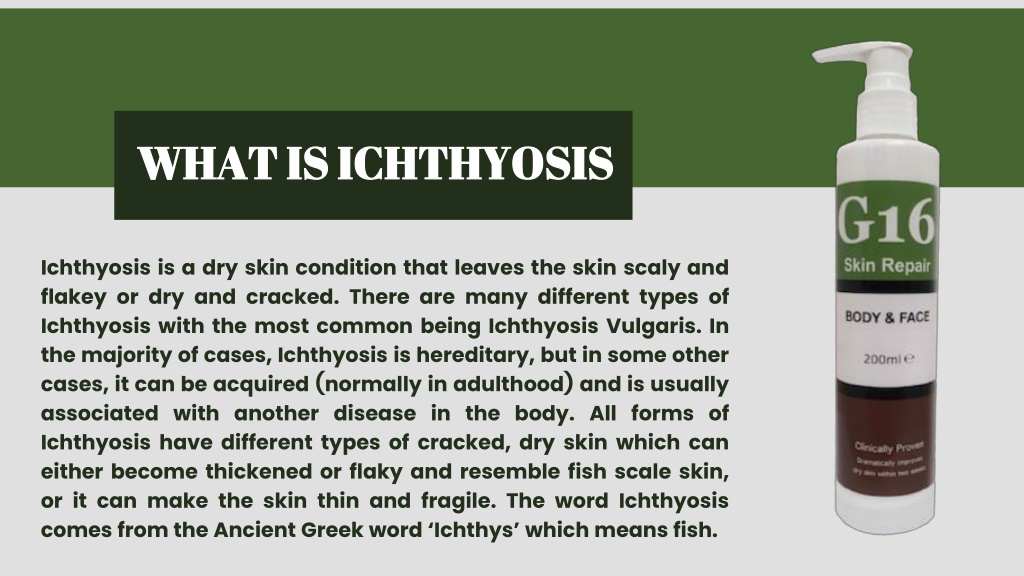 Ppt Ichthyosis Symptoms And Treatments G16 Lotion Powerpoint Presentation Id11674235 8934