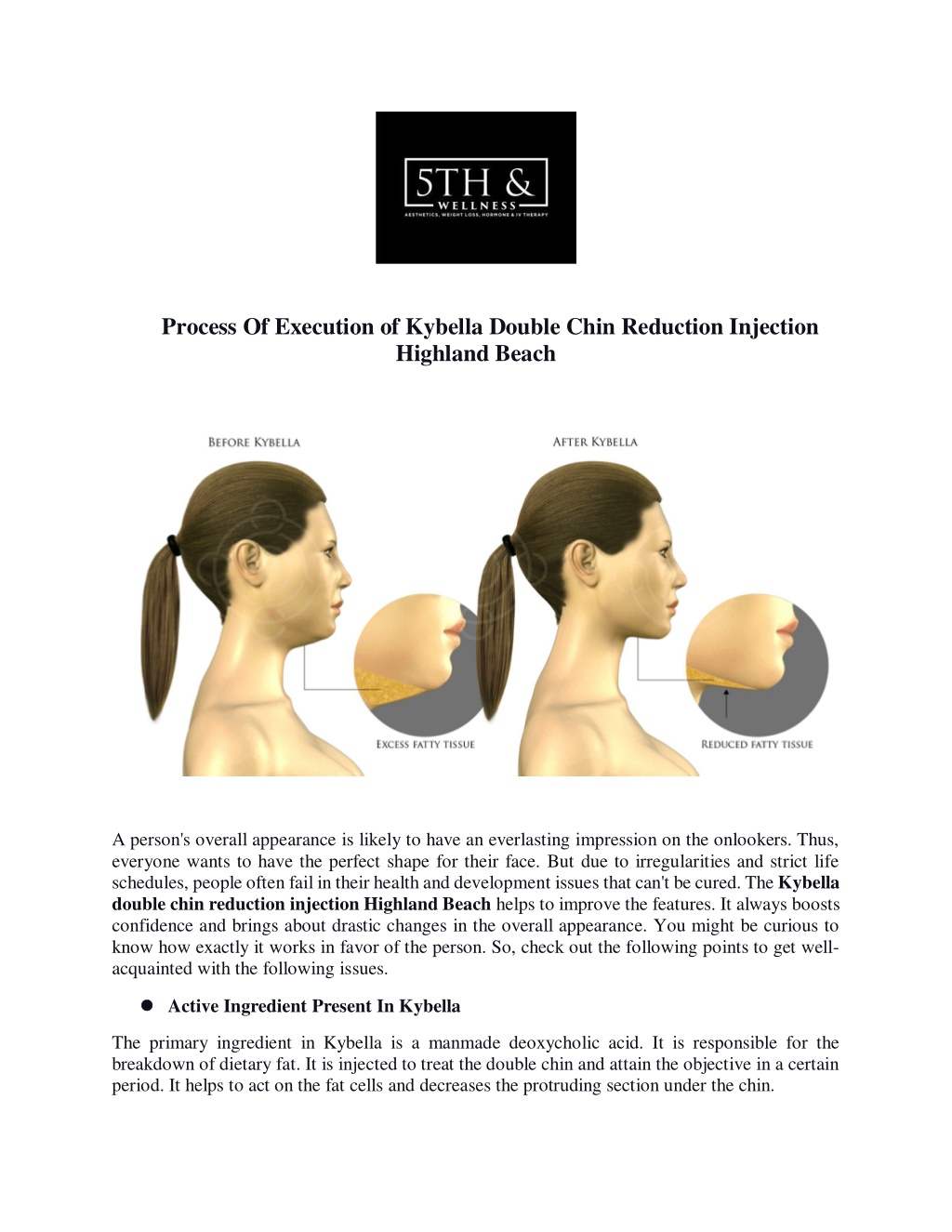 Ppt Process Of Execution Of Kybella Double Chin Reduction Injection Highland Beach Powerpoint 0088