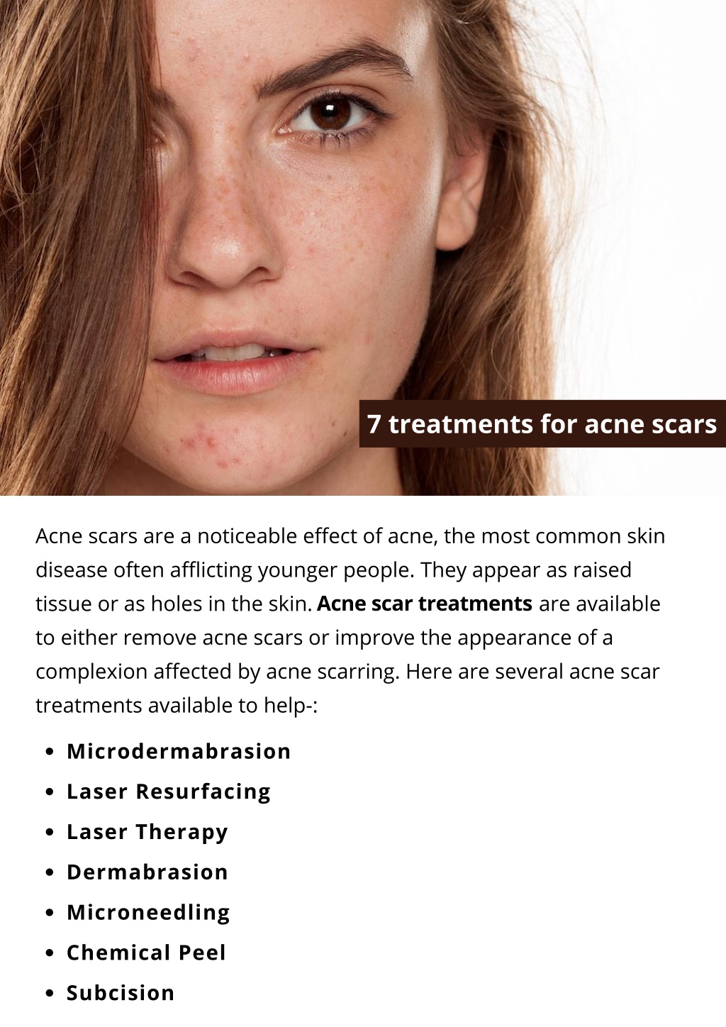 ppt-7-treatments-for-acne-scars-powerpoint-presentation-free