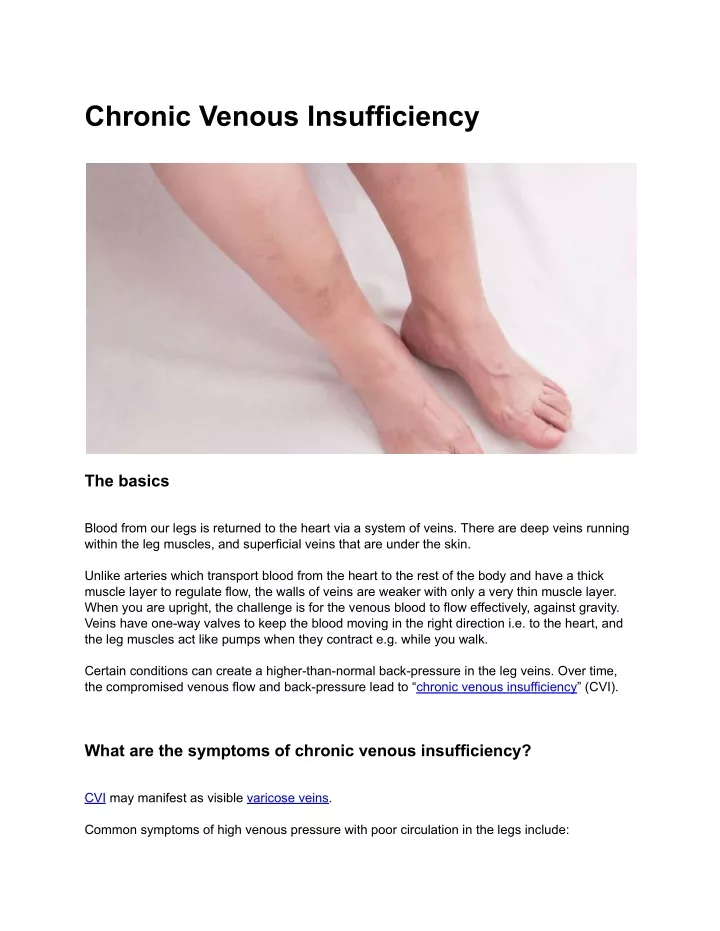 Ppt Chronic Venous Insufficiency Powerpoint Presentation Free Download Id11707270 2255