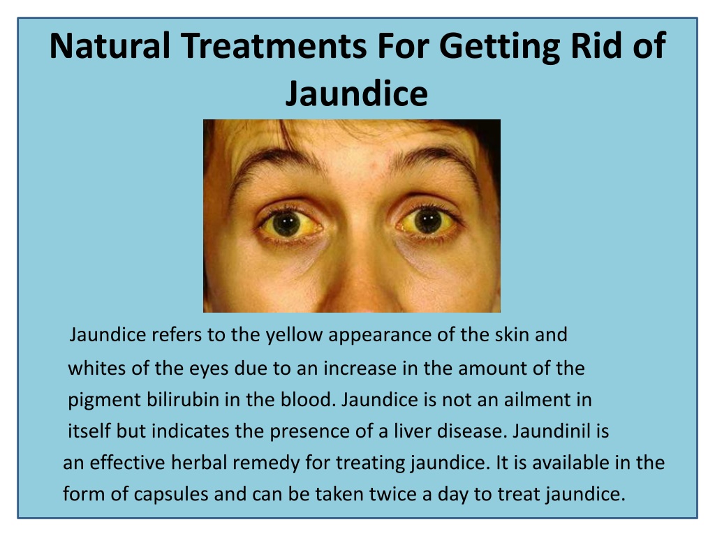 Ppt Best Herbal Treatment For Jaundice Powerpoint Presentation Free Download Id11710498 9964