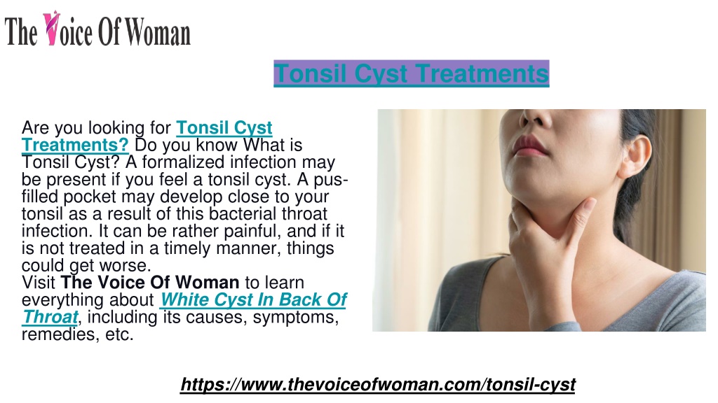 PPT - Tonsil Cyst Treatments PowerPoint Presentation, free download ...