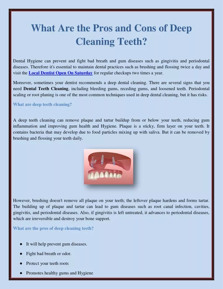 PPT - What Are The Pros And Cons Of Deep Cleaning Teeth? PowerPoint ...