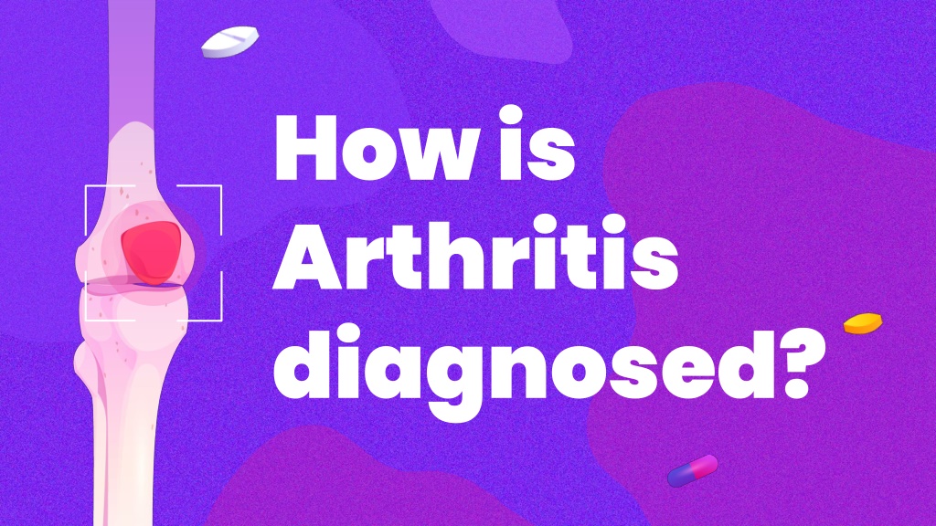 Ppt Do You Suffer From Arthritis Powerpoint Presentation Free Download Id11725448 5785