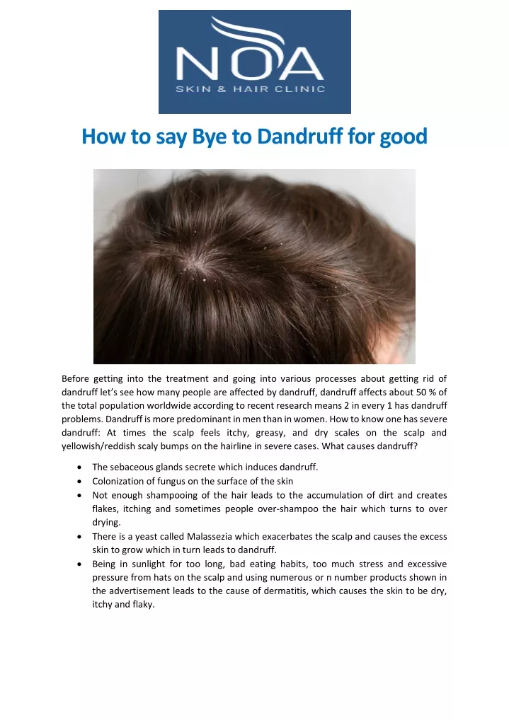 ppt-how-to-say-bye-to-dandruff-for-good-powerpoint-presentation-free