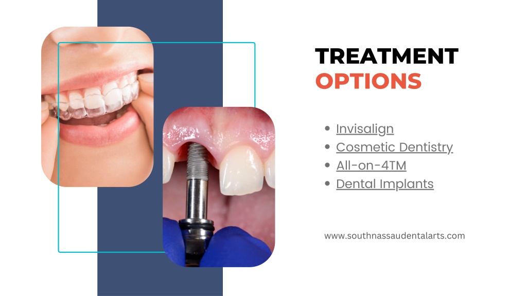 PPT - South Nassau Dental Arts PowerPoint Presentation, free download -  ID:11735060