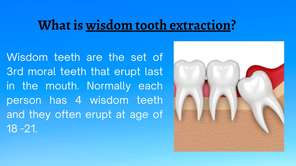 PPT - Wisdom Tooth Removal PowerPoint Presentation, Free Download - ID ...