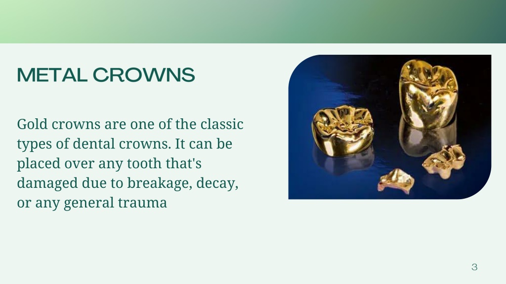 PPT Dental Crowns All you need to know PowerPoint Presentation