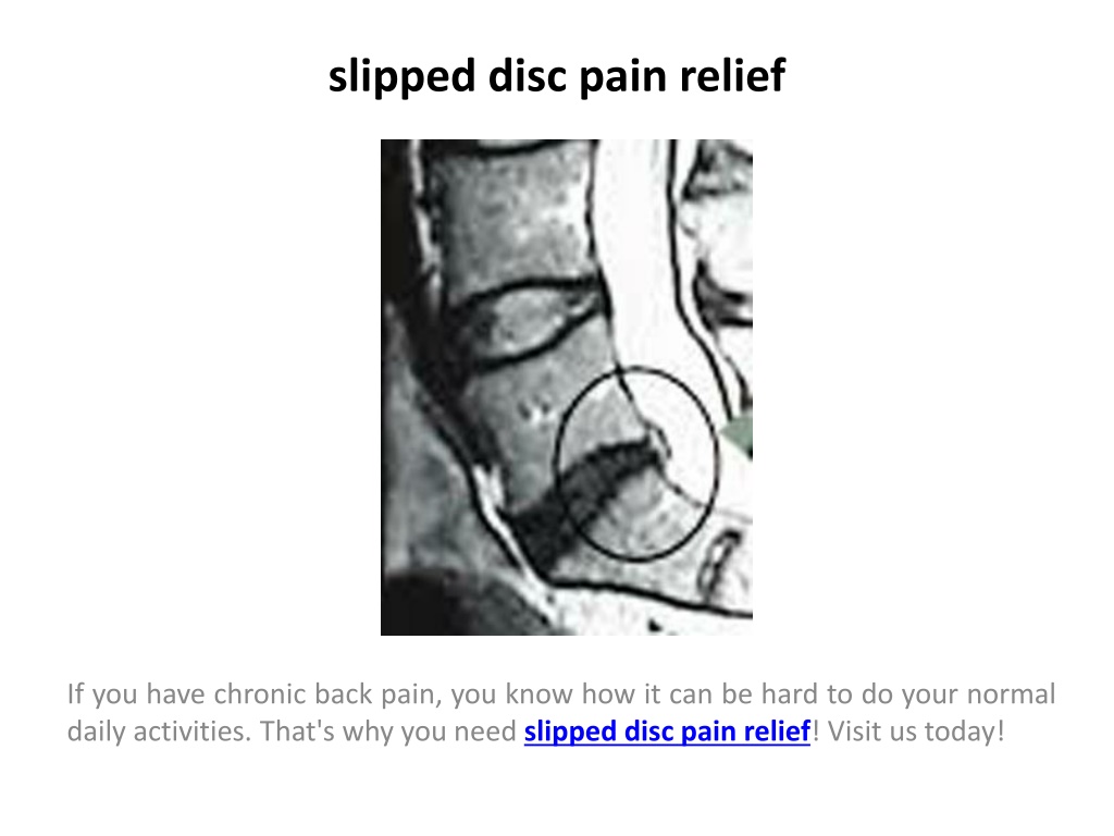 PPT - orthopedic pain management PowerPoint Presentation, free download ...