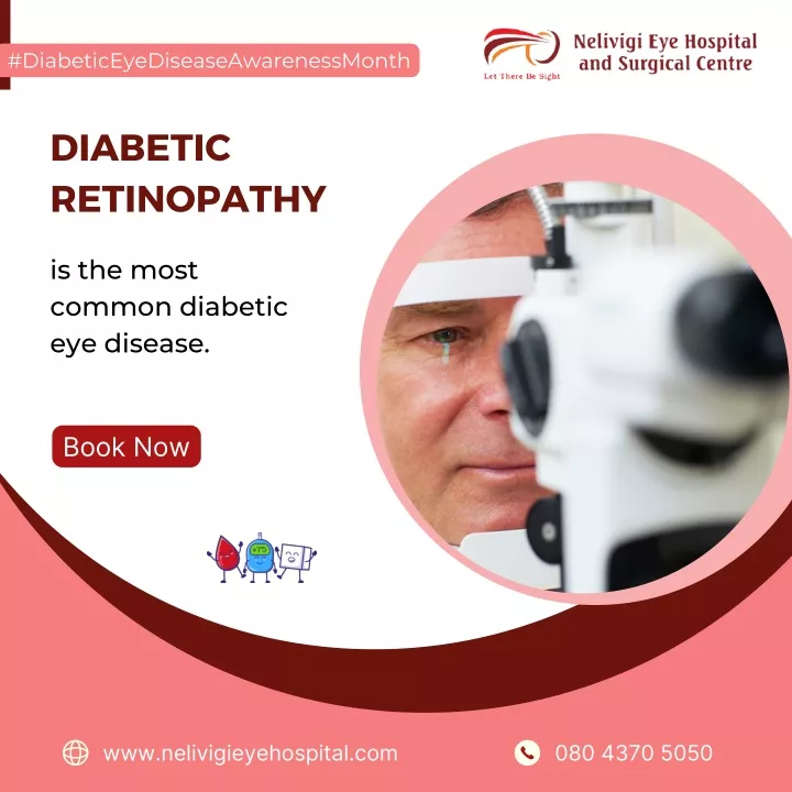 ppt-common-diabetic-eye-disease-best-eye-hospital-in-bellandur