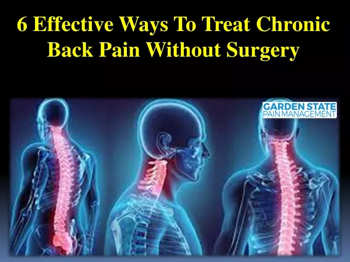 ppt-6-effective-ways-to-treat-chronic-back-pain-without-surgery