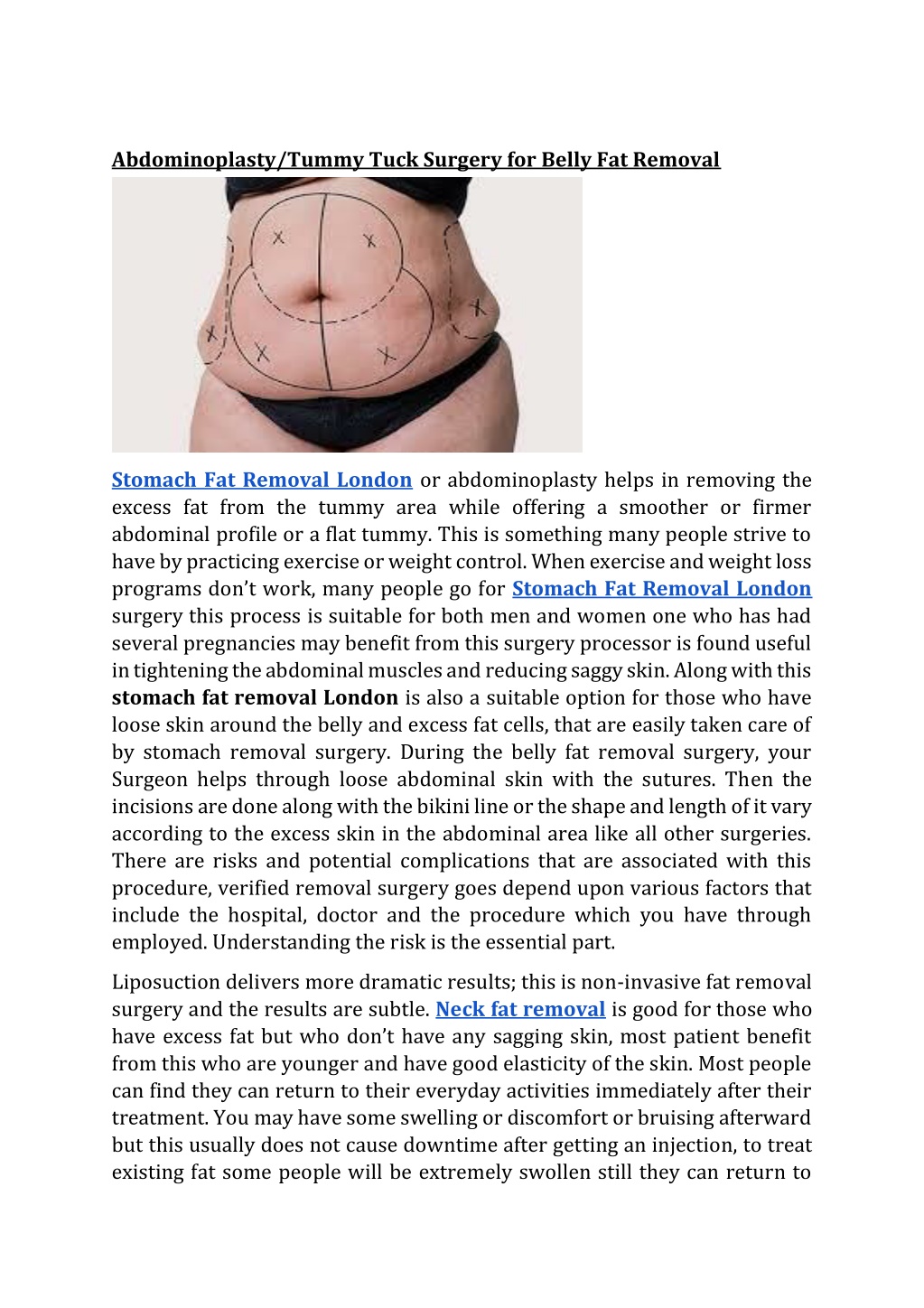 Ppt Abdominoplastytummy Tuck Surgery For Belly Fat Removal Powerpoint Presentation Id11796670