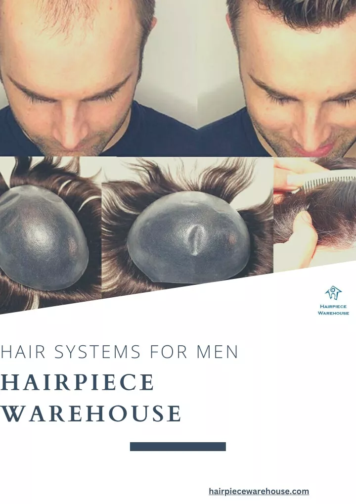 Best Options for Selling Hair Pieces for Men