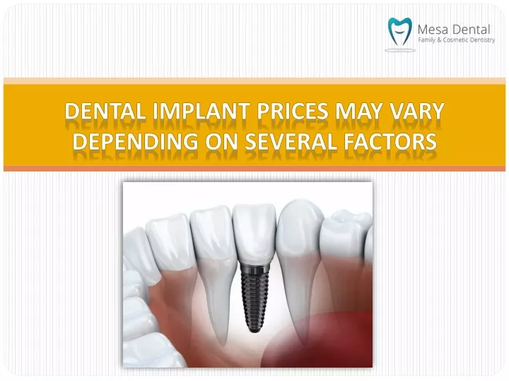 PPT - Dental Implant Prices May Vary Depending On Several Factors ...