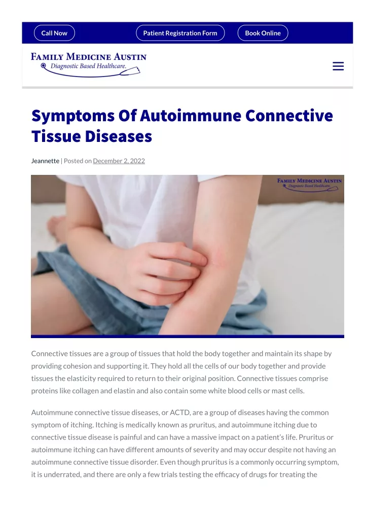 Ppt Autoimmune Connective Tissue Diseases Powerpoint Presentation Free Download Id 11801188