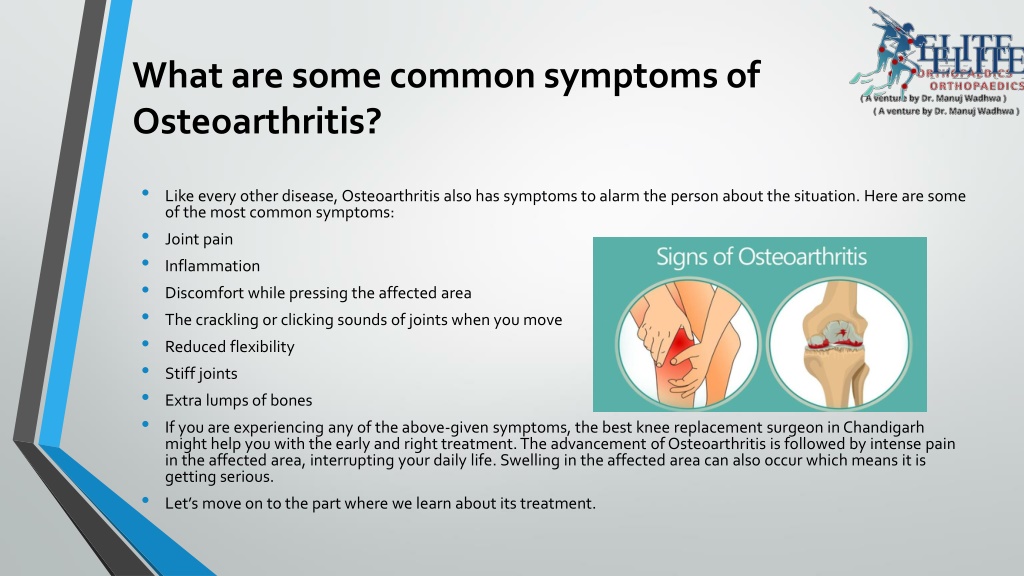 Ppt All You Needall You Need To Know About Osteoarthri To Know About